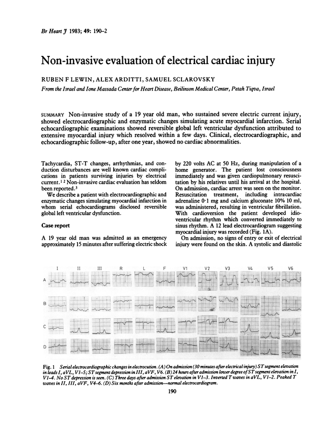 PDF extract preview
